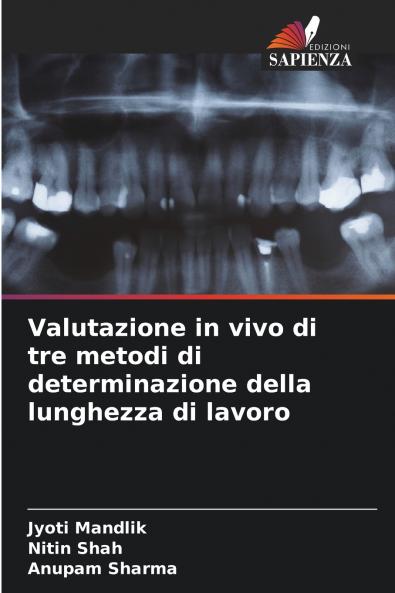 Valutazione in vivo di tre metodi di determinazione della lunghezza di lavoro