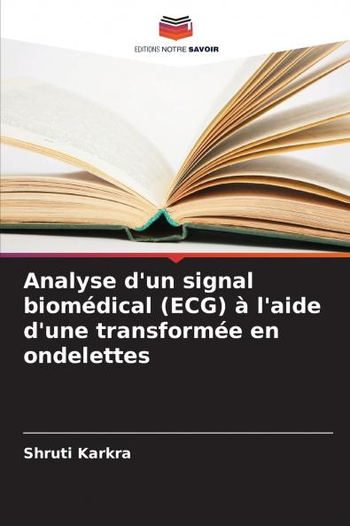 Analyse d'un signal biomédical (ECG) à l'aide d'une transformée en ondelettes