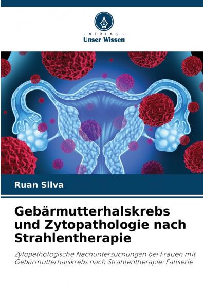Gebärmutterhalskrebs und Zytopathologie nach Strahlentherapie