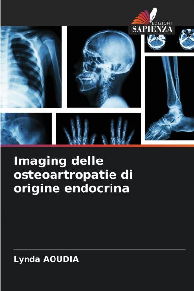 Imaging delle osteoartropatie di origine endocrina