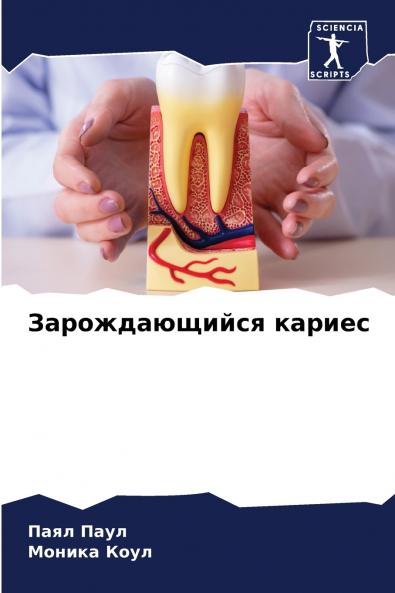 Зарождающийся кариес