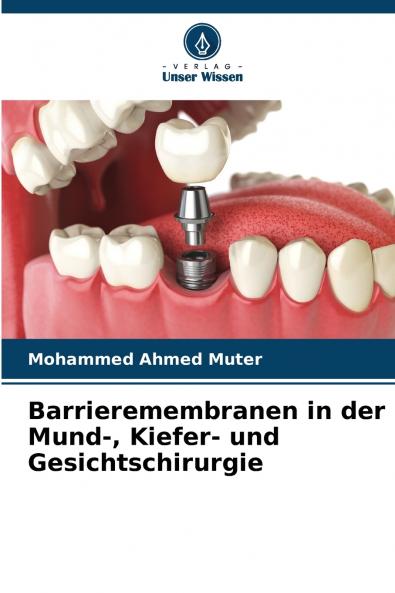 Barrieremembranen in der Mund- Kiefer- und Gesichtschirurgie