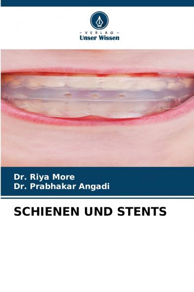 SCHIENEN UND STENTS