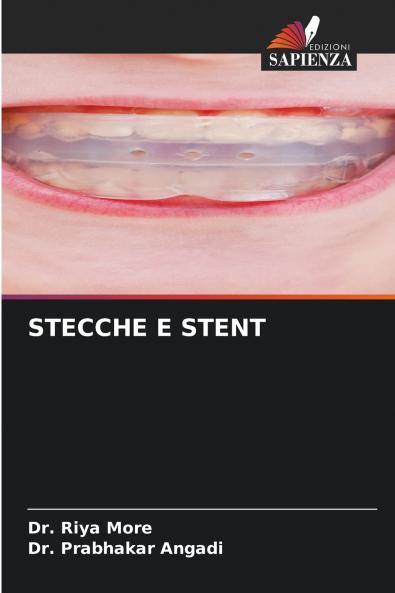 STECCHE E STENT