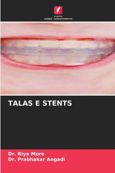 TALAS E STENTS