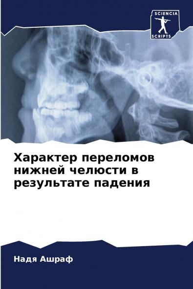 ???????? ????????? ?????? ??????? ? ?????????? ???????