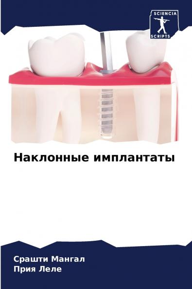 ????????? ??????????