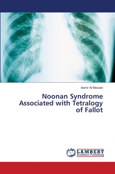Noonan Syndrome Associated with Tetralogy of Fallot
