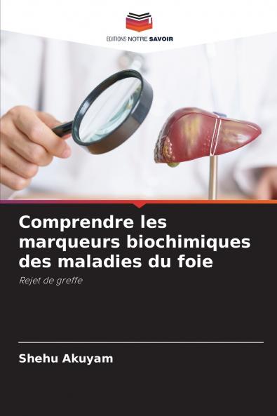 Comprendre les marqueurs biochimiques des maladies du foie