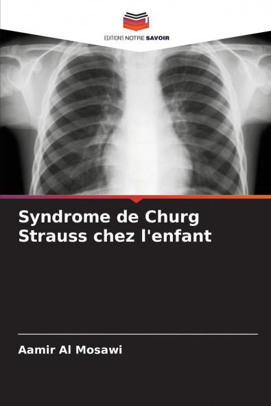 Syndrome de Churg Strauss chez l'enfant