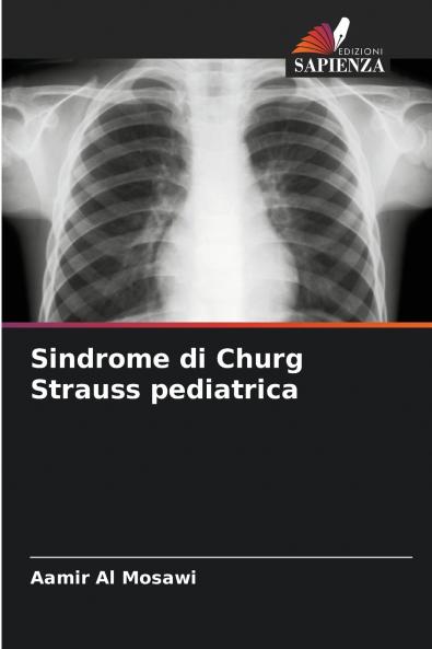 Sindrome di Churg Strauss pediatrica
