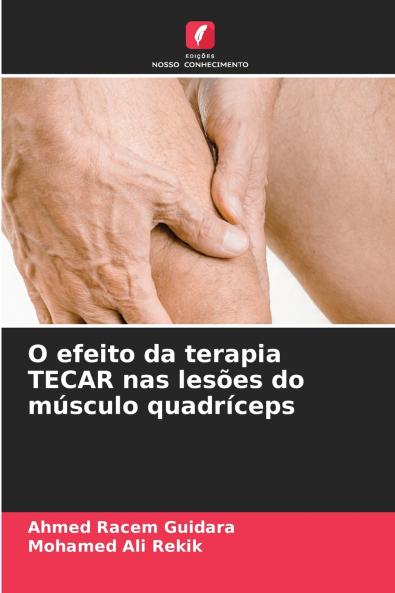 O efeito da terapia TECAR nas lesões do músculo quadríceps