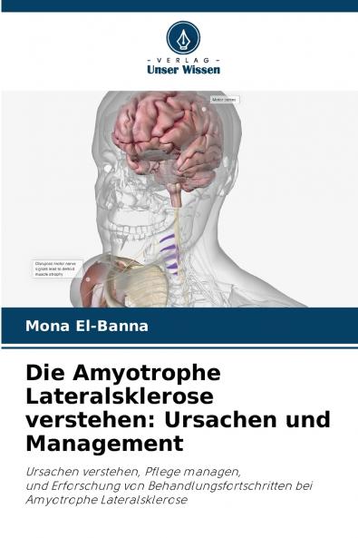 Die Amyotrophe Lateralsklerose verstehen