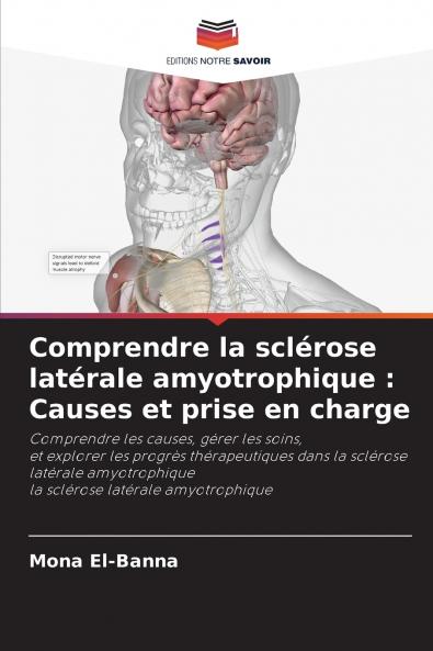 Comprendre la sclérose latérale amyotrophique
