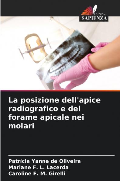La posizione dell'apice radiografico e del forame apicale nei molari