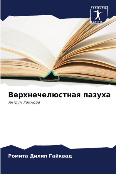 Верхнечелюстная пазуха