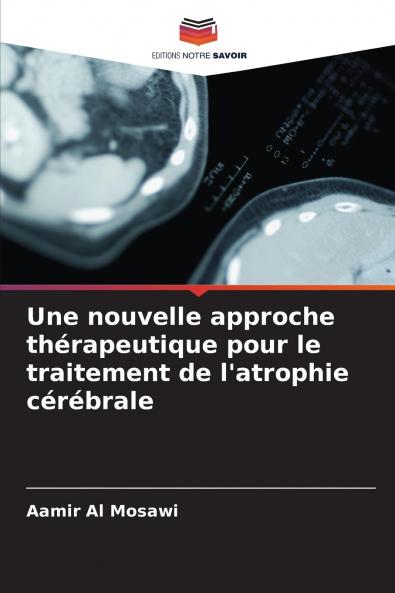 Une nouvelle approche thérapeutique pour le traitement de l'atrophie cérébrale
