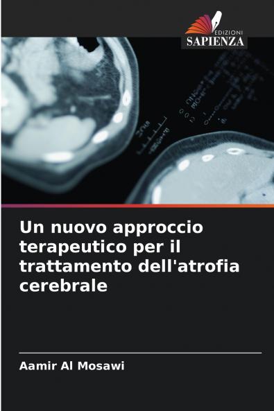 Un nuovo approccio terapeutico per il trattamento dell'atrofia cerebrale