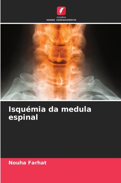Isquémia da medula espinal