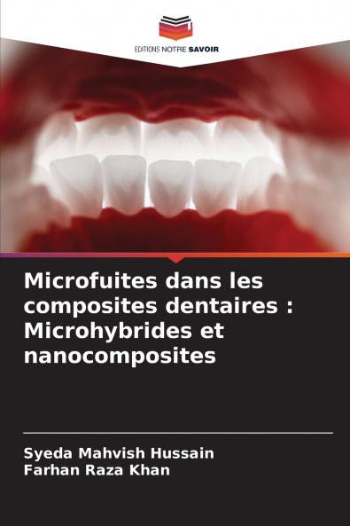 Microfuites dans les composites dentaires
