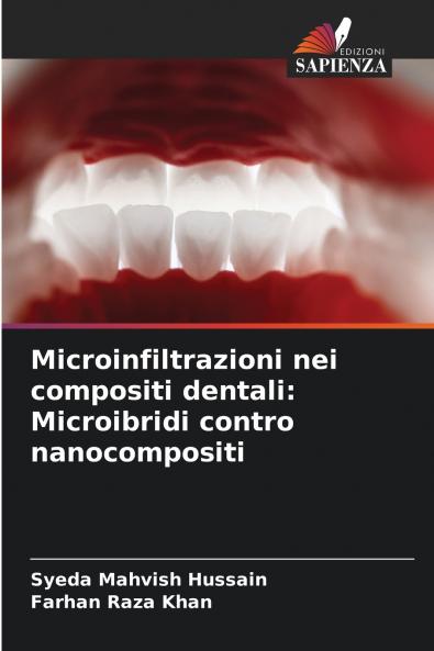 Microinfiltrazioni nei compositi dentali