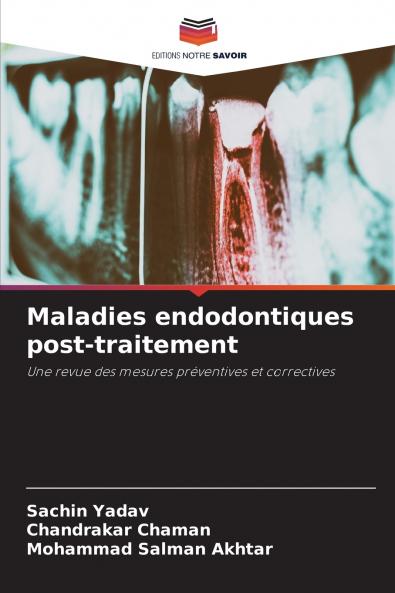 Maladies endodontiques post-traitement