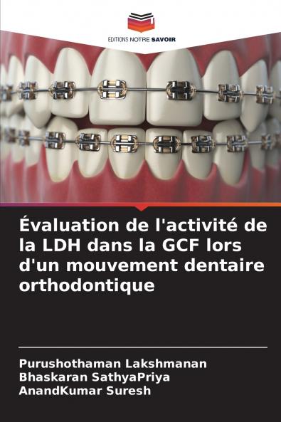 Évaluation de l'activité de la LDH dans la GCF lors d'un mouvement dentaire orthodontique