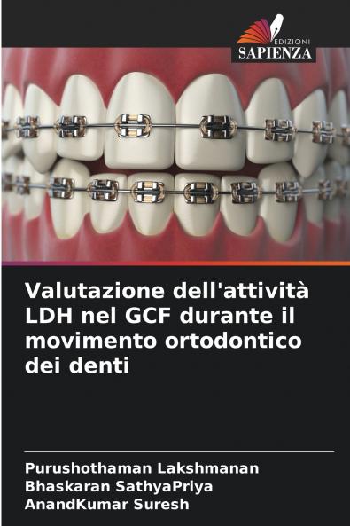 Valutazione dell'attività LDH nel GCF durante il movimento ortodontico dei denti