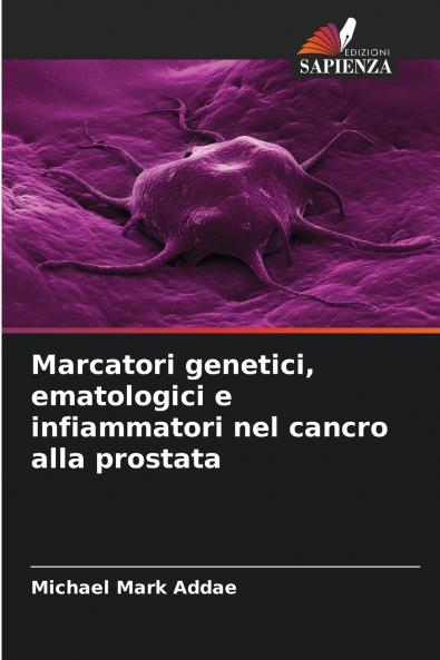 Marcatori genetici ematologici e infiammatori nel cancro alla prostata