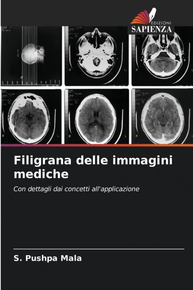 Filigrana delle immagini mediche