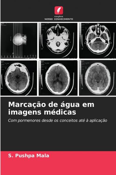 Marcação de água em imagens médicas