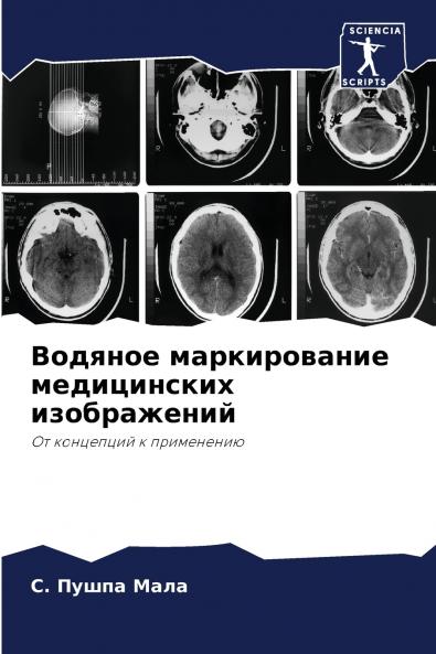 Водяное маркирование медицинских изображений
