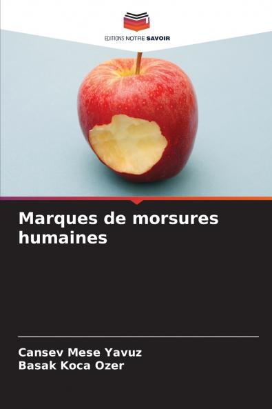 Marques de morsures humaines