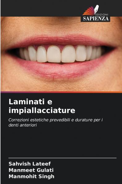Laminati e impiallacciature