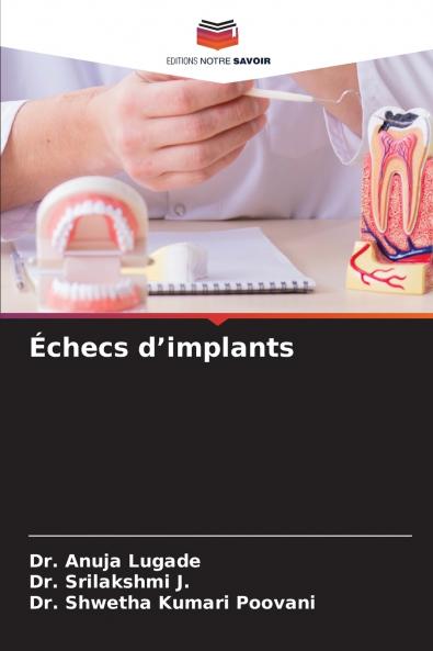 Échecs d'implants