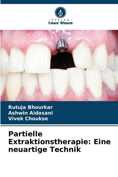 Partielle Extraktionstherapie