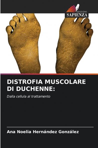 DISTROFIA MUSCOLARE DI DUCHENNE