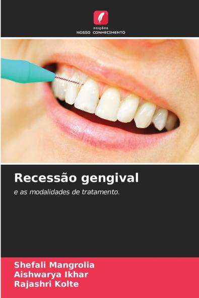 Recessão gengival