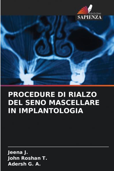PROCEDURE DI RIALZO DEL SENO MASCELLARE IN IMPLANTOLOGIA