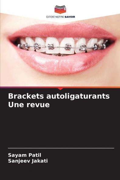 Brackets autoligaturants Une revue