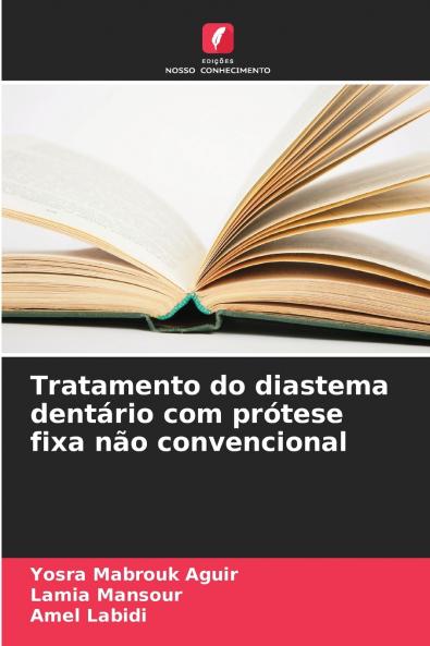 Tratamento do diastema dentário com prótese fixa não convencional