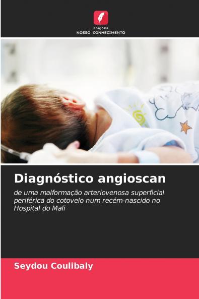 Diagnóstico angioscan