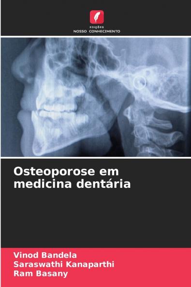 Osteoporose em medicina dentária