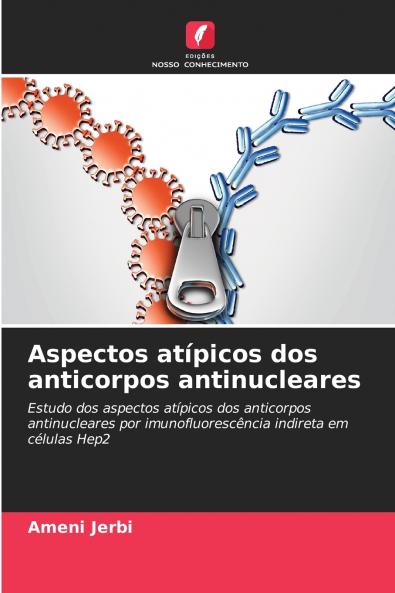 Aspectos atípicos dos anticorpos antinucleares