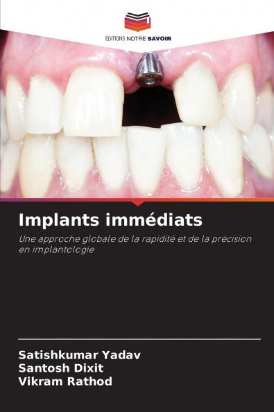 Implants immédiats
