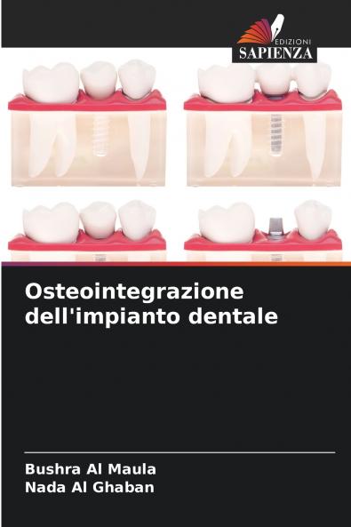 Osteointegrazione dell'impianto dentale