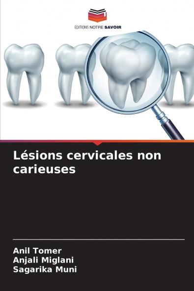 Lésions cervicales non carieuses