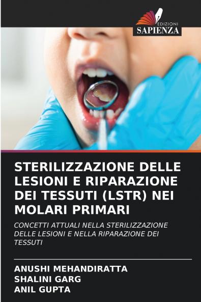 STERILIZZAZIONE DELLE LESIONI E RIPARAZIONE DEI TESSUTI (LSTR) NEI MOLARI PRIMARI