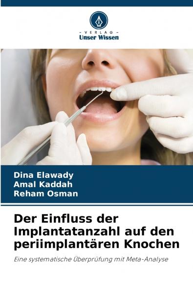 Der Einfluss der Implantatanzahl auf den periimplantären Knochen