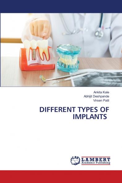 DIFFERENT TYPES OF IMPLANTS